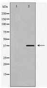 SUCNR1 / GPR91 Antibody - Western blot of SUCNR1 expression in HUVEC cells