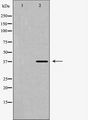 SUCNR1 / GPR91 Antibody - Western blot analysis of SUCNR1 expression in HuvEc cells. The lane on the left is treated with the antigen-specific peptide.