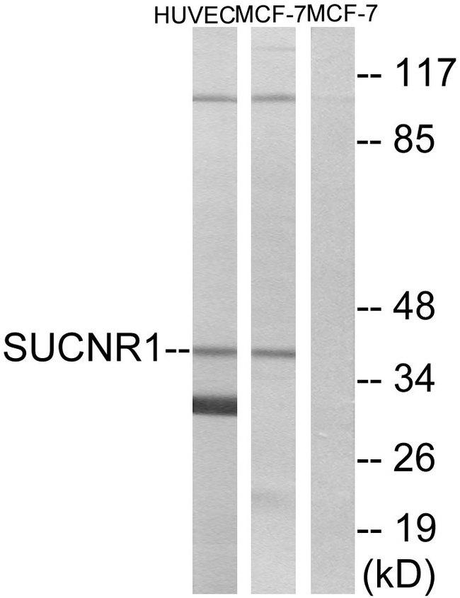 SUCNR1 / GPR91 Antibody - Western blot analysis of extracts from HUVEC cells and MCF-7 cells, using SUCNR1 antibody.