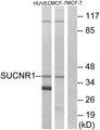 SUCNR1 / GPR91 Antibody - Western blot analysis of extracts from HUVEC cells and MCF-7 cells, using SUCNR1 antibody.