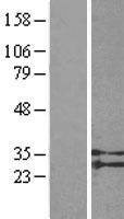 SUCNR1 / GPR91 Protein - Western validation with an anti-DDK antibody * L: Control HEK293 lysate R: Over-expression lysate