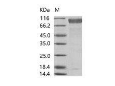 Sudan Ebola Virus GP1 Protein - Recombinant EBOV (subtype Sudan, strain Gulu) GP1 / Glycoprotein Protein (His Tag)