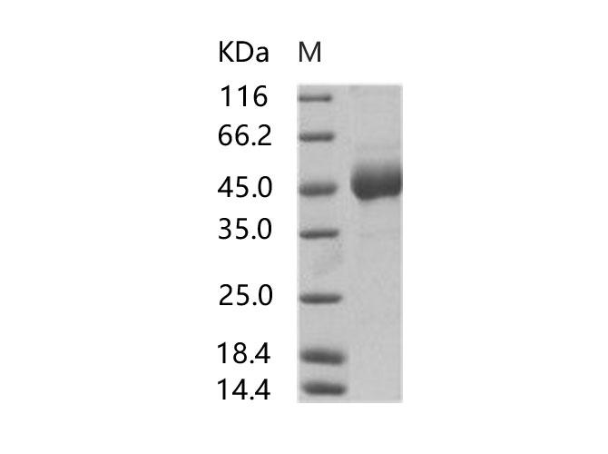 Sudan Ebola Virus GP1 Protein - Recombinant EBOV (Subtype Sudan, strain Gulu) Glycoprotein / GP1 (mucin domain deleted) Protein (His Tag)