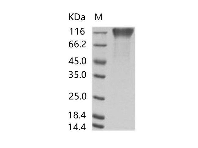 Sudan Ebola Virus GP1 Protein - Recombinant EBOV (subtype Sudan, strain Gulu) GP1 / Glycoprotein Protein (His Tag)