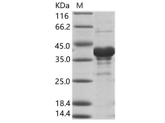 Sudan Ebola Virus Matrix Protein VP40 Protein - Recombinant EBOV (subtype Sudan, strain Gulu) VP40 / Matrix protein VP40 Protein (His Tag)