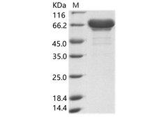 Sudan Ebola Virus Matrix Protein VP40 Protein - Recombinant EBOV (subtype Sudan, strain Gulu) VP40 / Matrix protein VP40 Protein (His & MBP Tag)