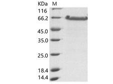 Sudan Ebola virus Nucleoprotein Protein - Recombinant EBOV (Sudan ebolavirus, strain Gulu) Nucleoprotein / NP (aa361-aa738) Protein (His Tag)