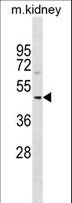 SUDS3 Antibody - SUDS3 Antibody western blot of mouse kidney tissue lysates (35 ug/lane). The SUDS3 antibody detected the SUDS3 protein (arrow).