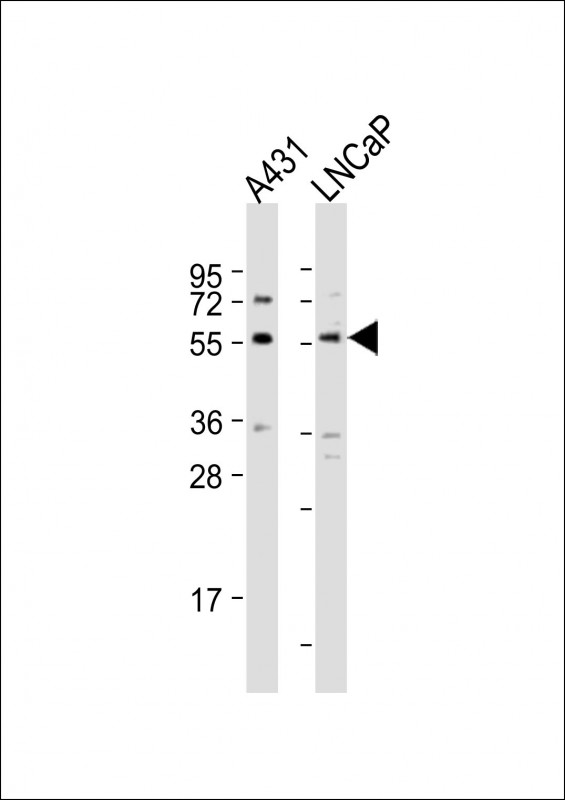 SUFU Antibody - All lanes: Anti-SUFU Antibody (C-term) at 1:2000 dilution. Lane 1: A431 whole cell lysate. Lane 2: LNCaP whole cell lysate Lysates/proteins at 20 ug per lane. Secondary Goat Anti-Rabbit IgG, (H+L), Peroxidase conjugated at 1:10000 dilution. Predicted band size: 54 kDa. Blocking/Dilution buffer: 5% NFDM/TBST.
