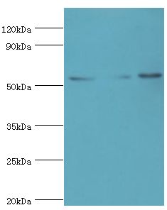 SUFU Antibody - Western blot. All lanes: Suppressor of fused homolog antibody at 4 ug/ml. Lane 1: HepG2 whole cell lysate. Lane 2: HeLa whole cell lysate. Lane 3: mouse kidney tissue. secondary Goat polyclonal to rabbit at 1:10000 dilution. Predicted band size: 54 kDa. Observed band size: 54 kDa.