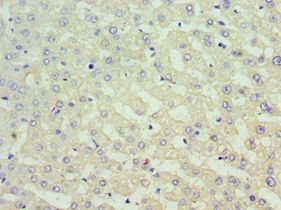 SUFU Antibody - Immunohistochemistry of paraffin-embedded human liver using antibody at 1:100 dilution.