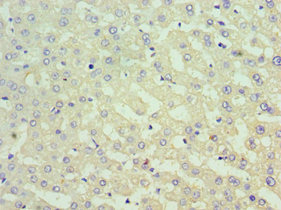 SUFU Antibody - Immunohistochemistry of paraffin-embedded human liver tissue using SUFU Antibody at dilution of 1:100