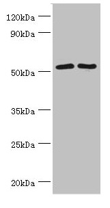 SUFU Antibody - Western blot All lanes: Suppressor of fused homolog antibody at 4µg/ml Lane 1: HepG2 whole cell lysate Lane 2: Hela whole cell lysate Lane 3: Mouse kidney tissue Secondary Goat polyclonal to rabbit IgG at 1/10000 dilution Predicted band size: 54, 48, 53 kDa Observed band size: 54 kDa