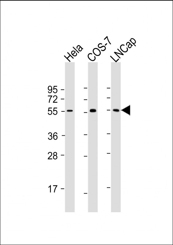 SUFU Antibody - All lanes: Anti-SUFU Antibody at 1:2000 dilution Lane 1: Hela whole cell lysate Lane 2: COS-7 whole cell lysate Lane 3: LNCap whole cell lysate Lysates/proteins at 20 µg per lane. Secondary Goat Anti-mouse IgG, (H+L), Peroxidase conjugated at 1/10000 dilution. Predicted band size: 54 kDa Blocking/Dilution buffer: 5% NFDM/TBST.
