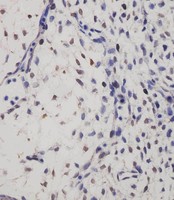 SUFU Antibody - SUFU Antibody staining SUFU in mouse embryo tissue sections by Immunohistochemistry (IHC-P - paraformaldehyde-fixed, paraffin-embedded sections). Tissue was fixed with formaldehyde and blocked with 3% BSA for 0. 5 hour at room temperature; antigen retrieval was by heat mediation with a citrate buffer (pH6). Samples were incubated with primary antibody (1/25) for 1 hours at 37°C. A undiluted biotinylated goat polyvalent antibody was used as the secondary antibody.