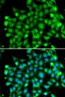 SUFU Antibody - Immunofluorescence analysis of MCF-7 cells using SUFU antibody. Blue: DAPI for nuclear staining.