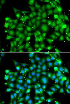 SUFU Antibody - Immunofluorescence analysis of MCF-7 cells using SUFU antibody. Blue: DAPI for nuclear staining.