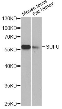 SUFU Antibody - Western blot analysis of extracts of various cell lines, using SUFU antibody at 1:1000 dilution. The secondary antibody used was an HRP Goat Anti-Rabbit IgG (H+L) at 1:10000 dilution. Lysates were loaded 25ug per lane and 3% nonfat dry milk in TBST was used for blocking. An ECL Kit was used for detection and the exposure time was 90s.