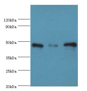 SUGCT / C7orf10 Antibody - Western blot. All lanes: SUGCT antibody at 16 ug/ml. Lane 1: mouse skeletal muscle tissue. Lane 2: mouse liver tissue. Lane 3: mouse kidney tissue. Secondary antibody: Goat polyclonal to rabbit at 1:10000 dilution. Predicted band size: 42 kDa. Observed band size: 42 kDa.