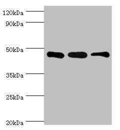 SUGCT / C7orf10 Antibody - Western blot All lanes: SUGCT antibody at 16µg/ml Lane 1: Mouse skeletal muscle tissue Lane 2: Mouse liver tissue Lane 3: Mouse kidney tissue Secondary Goat polyclonal to rabbit IgG at 1/10000 dilution Predicted band size: 49, 48, 52, 44 kDa Observed band size: 42 kDa