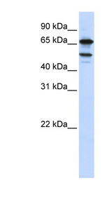 SUGP1 / SF4 Antibody - SUGP1 / SF4 antibody Western blot of HeLa lysate. This image was taken for the unconjugated form of this product. Other forms have not been tested.