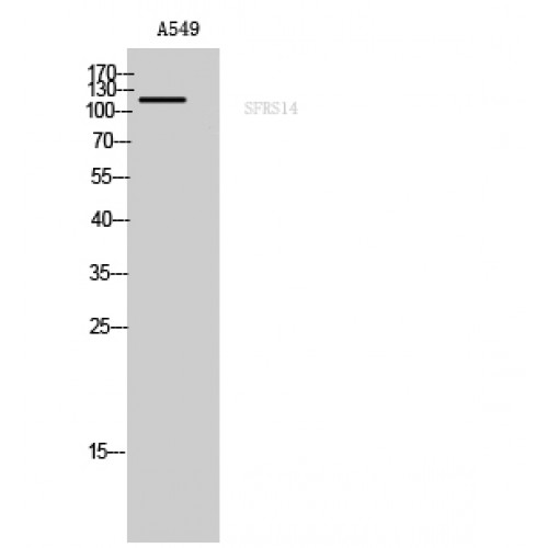 SUGP2 / SFRS14 Antibody - Western blot of SFRS14 antibody