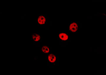 SUGP2 / SFRS14 Antibody - Staining HeLa cells by IF/ICC. The samples were fixed with PFA and permeabilized in 0.1% Triton X-100, then blocked in 10% serum for 45 min at 25°C. The primary antibody was diluted at 1:200 and incubated with the sample for 1 hour at 37°C. An Alexa Fluor 594 conjugated goat anti-rabbit IgG (H+L) Ab, diluted at 1/600, was used as the secondary antibody.