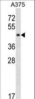 SUGT1 / SGT1 Antibody - SUGT1 Antibody western blot of A375 cell line lysates (35 ug/lane). The SUGT1 antibody detected the SUGT1 protein (arrow).