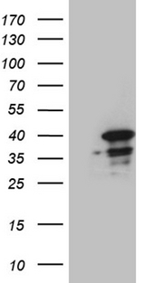 SUGT1 / SGT1 Antibody - HEK293T cells were transfected with the pCMV6-ENTRY control. (Left lane) or pCMV6-ENTRY SUGT1. (Right lane) cDNA for 48 hrs and lysed. Equivalent amounts of cell lysates. (5 ug per lane) were separated by SDS-PAGE and immunoblotted with anti-SUGT1. (1:2000)