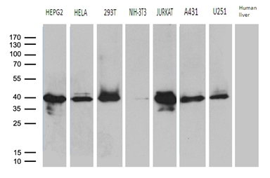 SUGT1 / SGT1 Antibody - Western blot analysis of extracts. (35ug) from 7 different cell lines and human liver tissue lysate by using anti-SUGT1 monoclonal antibody. (1:500)