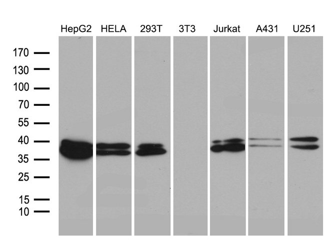 SUGT1 / SGT1 Antibody - Western blot analysis of extracts. (35ug) from 7 different cell lines by using anti-SUGT1 monoclonal antibody. (1:500)