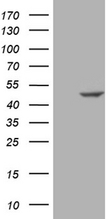 SUGT1 / SGT1 Antibody - HEK293T cells were transfected with the pCMV6-ENTRY control. (Left lane) or pCMV6-ENTRY SUGT1. (Right lane) cDNA for 48 hrs and lysed