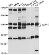 SUGT1 / SGT1 Antibody - Western blot analysis of extracts of various cell lines, using SUGT1 antibody at 1:1000 dilution. The secondary antibody used was an HRP Goat Anti-Rabbit IgG (H+L) at 1:10000 dilution. Lysates were loaded 25ug per lane and 3% nonfat dry milk in TBST was used for blocking. An ECL Kit was used for detection and the exposure time was 30s.