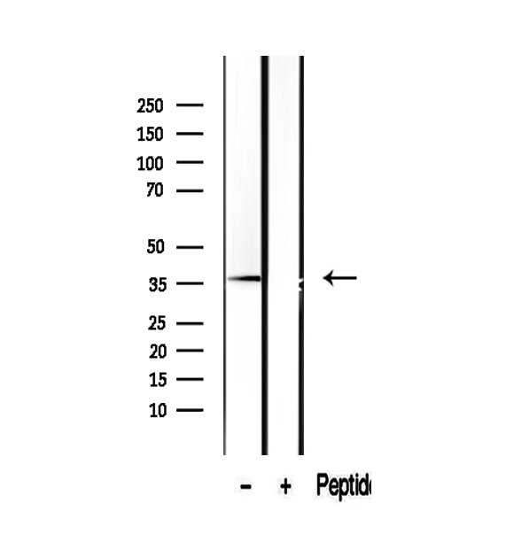 SUGT1 / SGT1 Antibody - Western blot analysis of extracts of human kidney tissue using SUGT1 antibody.