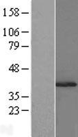 SUGT1 / SGT1 Protein - Western validation with an anti-DDK antibody * L: Control HEK293 lysate R: Over-expression lysate