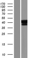 SUGT1 / SGT1 Protein - Western validation with an anti-DDK antibody * L: Control HEK293 lysate R: Over-expression lysate