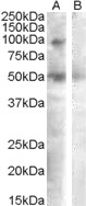 SULF2 / Sulfatase 2 Antibody - SULF2 antibody (0.3 ug/ml) staining of Human Ovary lysate (35 ug protein/ml in RIPA buffer) with (B) and without (A) blocking with the immunizing peptide. Primary incubation was 1 hour. Detected by chemiluminescence.