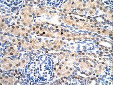 SULF2 / Sulfatase 2 Antibody - SULF2 / Sulfatase 2 antibody SULF2(sulfatase 2) Antibody was used in IHC to stain formalin-fixed, paraffin-embedded human kidney.  This image was taken for the unconjugated form of this product. Other forms have not been tested.