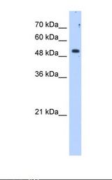 SULF2 / Sulfatase 2 Antibody - HepG2 cell lysate. Antibody concentration: 1.25 ug/ml. Gel concentration: 12%.  This image was taken for the unconjugated form of this product. Other forms have not been tested.