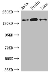 SULF2 / Sulfatase 2 Antibody - Positive WB detected in:Hela whole cell lysate,Mouse brain tissue,Rat lung tissue;All lanes:SULF2 antibody at 2.7?g/ml;Secondary;Goat polyclonal to rabbit IgG at 1/50000 dilution;Predicted band size: 101 KDa;Observed band size: 140 KDa;