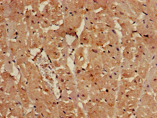 SULF2 / Sulfatase 2 Antibody - Immunohistochemistry of paraffin-embedded human heart tissue using SULF2 Antibody at dilution of 1:100