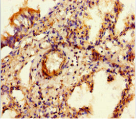 Sulfatase 1 / SULF1 Antibody - Immunohistochemistry of paraffin-embedded human lung tissue at dilution 1:100