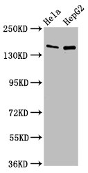 Sulfatase 1 / SULF1 Antibody - Western Blot Positive WB detected in:Hela whole cell lysate,HepG2 whole cell lysate All Lanes:SULF1 antibody at 4µg/ml Secondary Goat polyclonal to rabbit IgG at 1/50000 dilution Predicted band size: 102 KDa Observed band size: 150 KDa