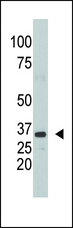 SULT1A1 / Sulfotransferase 1A1 Antibody - The anti-SULT1A1 antibody is used in Western blot to detect SULT1A1 in mouse kidney tissue lysate.