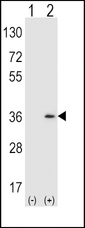 SULT1A1 / Sulfotransferase 1A1 Antibody - Western blot of SULT1A1 (arrow) using rabbit polyclonal SULT1A1 Antibody (Y143). 293 cell lysates (2 ug/lane) either nontransfected (Lane 1) or transiently transfected (Lane 2) with the SULT1A1 gene.