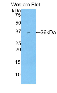 SULT1A1 / Sulfotransferase 1A1 Antibody - Western blot of recombinant Sulfotransferase 1A1 / SULT1A1.  This image was taken for the unconjugated form of this product. Other forms have not been tested.