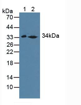 SULT1A1 / Sulfotransferase 1A1 Antibody - Western Blot; Sample: Lane1: Mouse Liver Tissue; Lane2: Rat Liver Tissue.