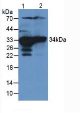 SULT1A1 / Sulfotransferase 1A1 Antibody - Western Blot; Sample. Lane1: Rat Liver Tissue; Lane2: Rat Kidney Tissue.