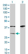 SULT1A1 / Sulfotransferase 1A1 Antibody - Western Blot analysis of SULT1A1 expression in transfected 293T cell line by SULT1A1 monoclonal antibody (M01A), clone 1F8.Lane 1: SULT1A1 transfected lysate(33.925 KDa).Lane 2: Non-transfected lysate.