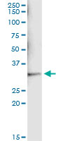 SULT1A1 / Sulfotransferase 1A1 Antibody - Immunoprecipitation of SULT1A1 transfected lysate using anti-SULT1A1 monoclonal antibody and Protein A Magnetic Bead, and immunoblotted with SULT1A1 monoclonal antibody.